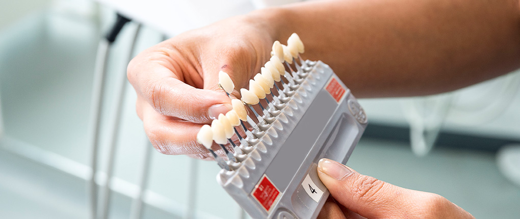 Schöne Zähne in Fulda, Kalbach: Veneers, Bleaching & Co.